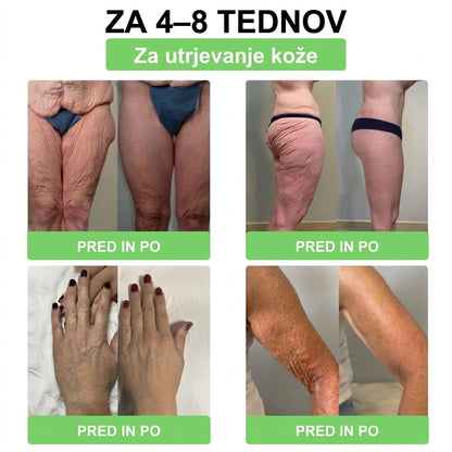 🇸🇮𝐑𝐚𝐳𝐯𝐢𝐭𝐨 𝐬 𝐬𝐭𝐫𝐚𝐧𝐢 𝐟𝐚𝐫𝐦𝐚𝐜𝐞𝐯𝐭𝐨𝐯🩺𝑫𝑶𝑻𝑨𝑳𝑬® 𝐌𝐨𝐫𝐢𝐧𝐠𝐚 𝐁𝐞𝐫𝐛𝐞𝐫𝐢𝐧𝐞 × 𝐍𝐀𝐃+ 𝟏𝟎-𝐯-𝟏 𝐍𝐚𝐩𝐫𝐞𝐝𝐧𝐢 𝐧𝐚𝐧𝐨 𝐦𝐢𝐤𝐫𝐨𝐢𝐠𝐥𝐢č𝐧𝐢 𝐨𝐛𝐥𝐢ž (𝐕𝐢𝐝𝐧𝐢 𝐫𝐞𝐳𝐮𝐥𝐭𝐚𝐭𝐢 ž𝐞 𝐯 𝟕 𝐝𝐧𝐞𝐡)
