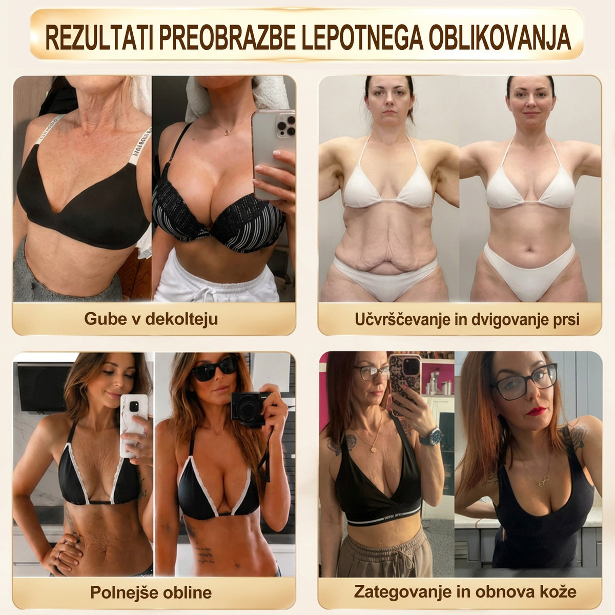 HISKIN®🏆 Nano mikroiglični obliži za volumen, dvig in učvrstitev prsi z voluminom + eksosomom + formulo bakrenih peptidov, ki jo poganja tehnologija obnavljanja celic